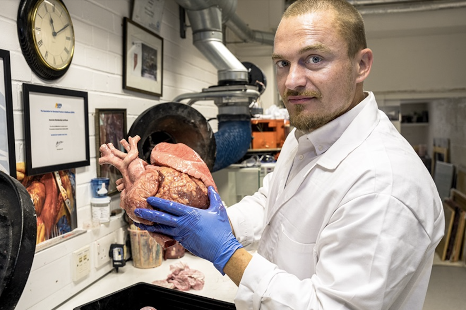 Le chercheur Richard Arm a utilisé les données d'un patient souffrant d'insuffisance cardiaque et d'un cœur de donneur sain pour imprimer en 3D des modèles réalistes.